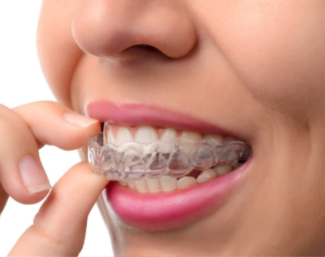 dentistry_thirty_two_putting_invisalign