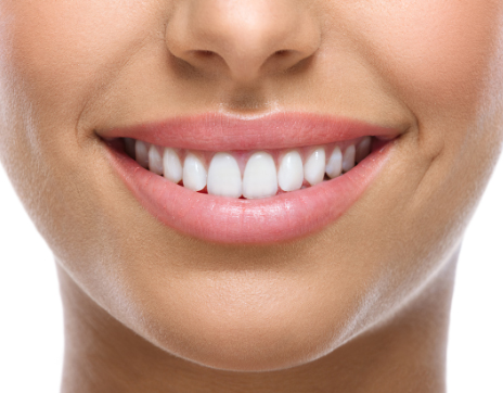 dentistry_thirty_two_wisdom_teet_extractions_woman_smiling