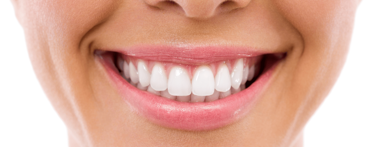 Common Causes Of Yellow Teeth