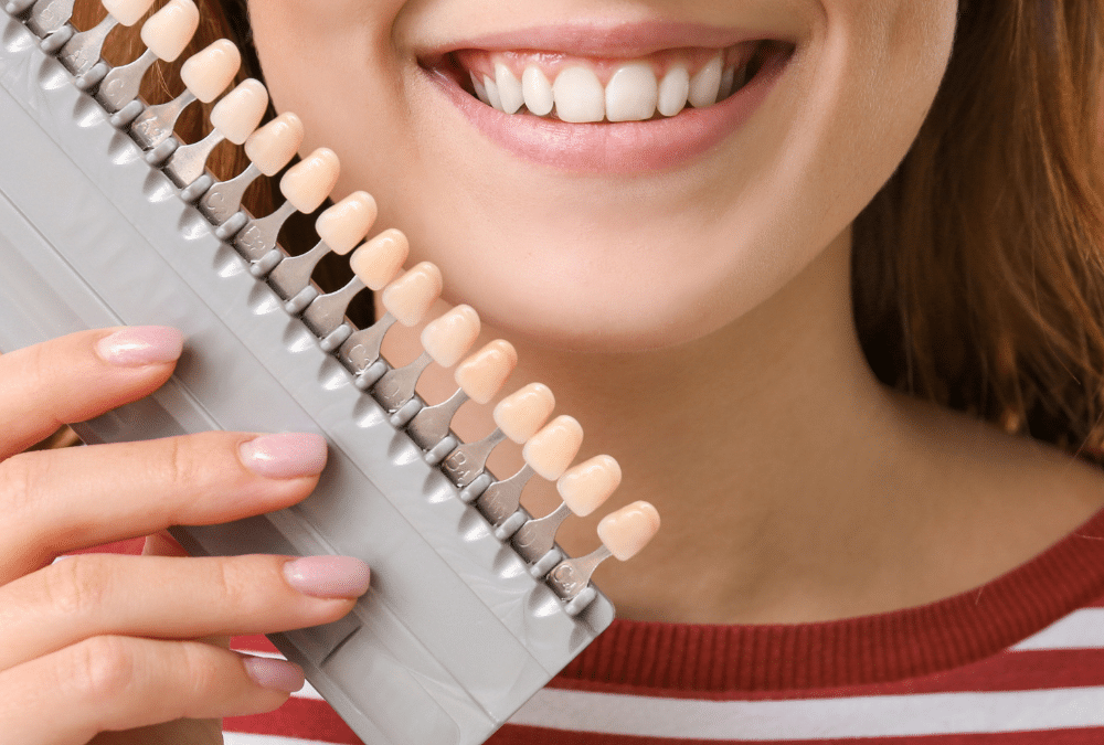 Enhance Your Smile With Dental Veneers & Teeth Whitening At Our Dentist’s Office in Maple Ridge