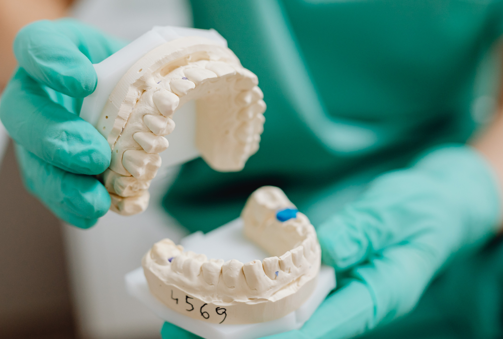 All About Dental Implants | Best Dentist in Maple Ridge