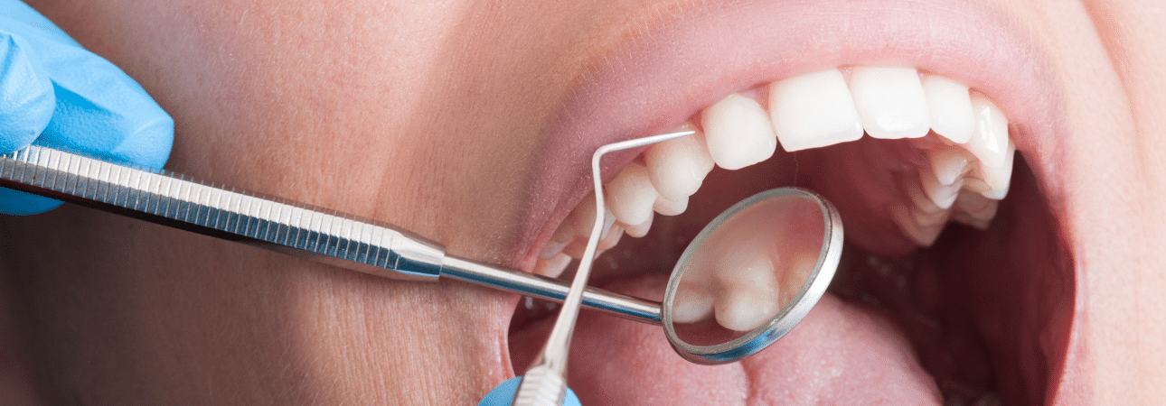 Dentist Services Maple Ridge