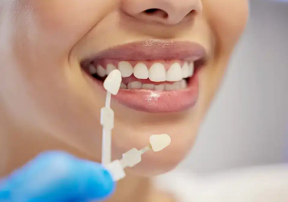 How does the Dental Crown and Bridge procedure work?