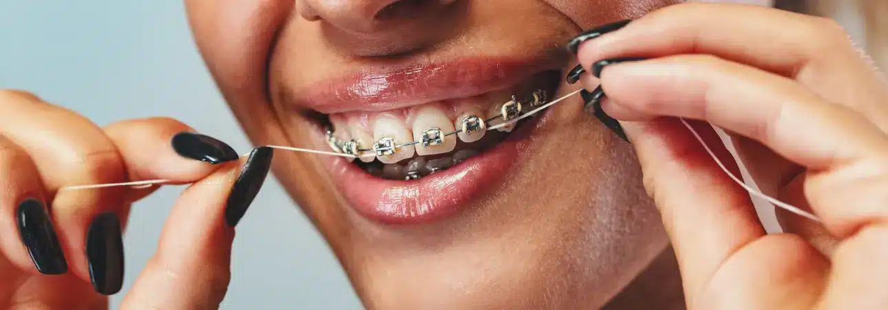Candy Bad for Your Teeth