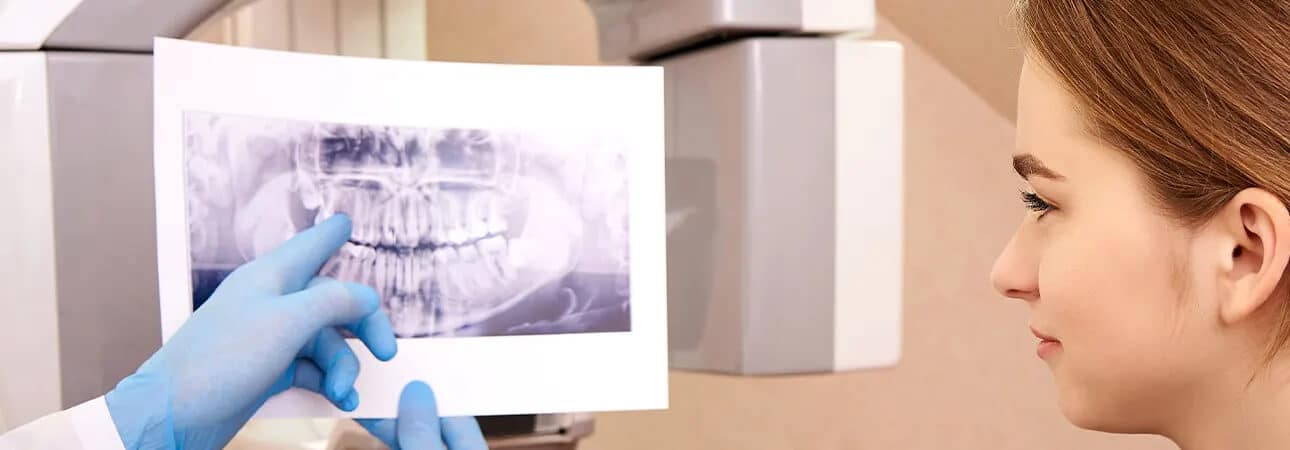  Dental X-rays